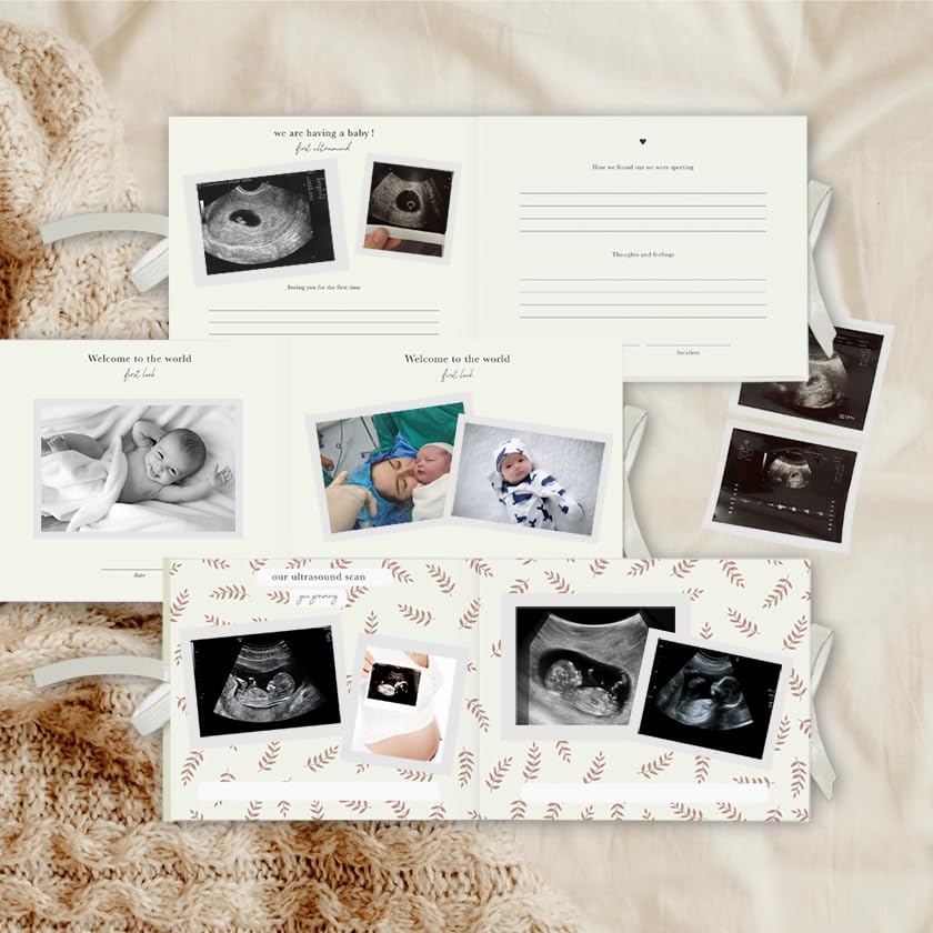 Diario de embarazo, diario de bebé para mamá